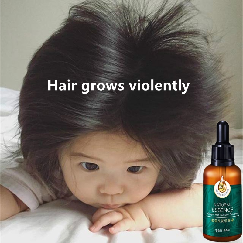 Hair Growth serum hair fall lebatkan rambut hair tonic growth  Hair Loss Treatment Ginger Hair care ginger essential oil