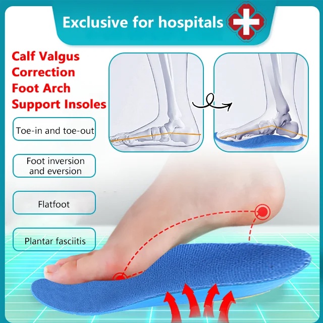 Calf Valgus Correction Foot Arch Support Insoles Shopee Malaysia