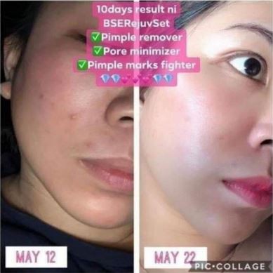 Shocking Sales Brilliant Skincare Skincare Yang Merawat Wajah Anda Berkesan Shopee Malaysia