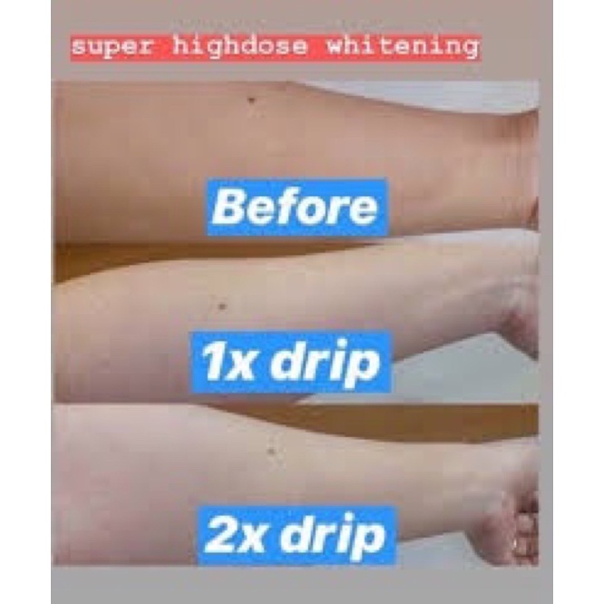 Buy Whitening Drip Cover Area Kl Selangor Seetracker Malaysia