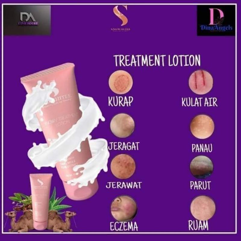 Treatment Lotion Susu Unta Snowhite