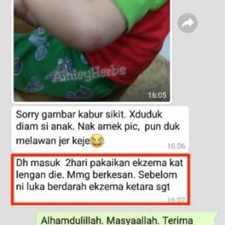 Krim Mujarab Ubat Ekzema, Kurap, Psoriasis, Kudis, Gatal 