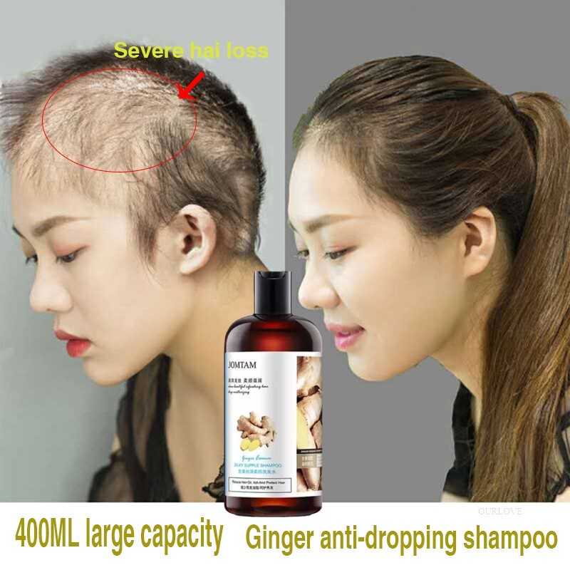 🔥IN STOCK🔥Hair Fall Shampoo Hair Growth Ginger Scalp Care Anti-dandruff  Oil-control Shampoo Hair Loss Regrowth | Shopee Malaysia