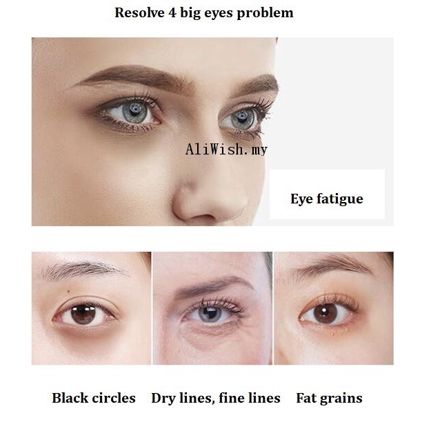 jomtam eyecare