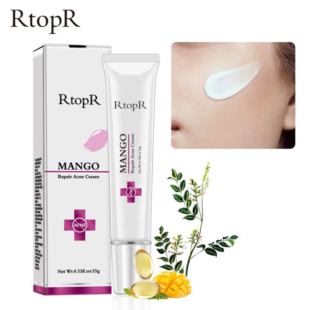 mango acne cream