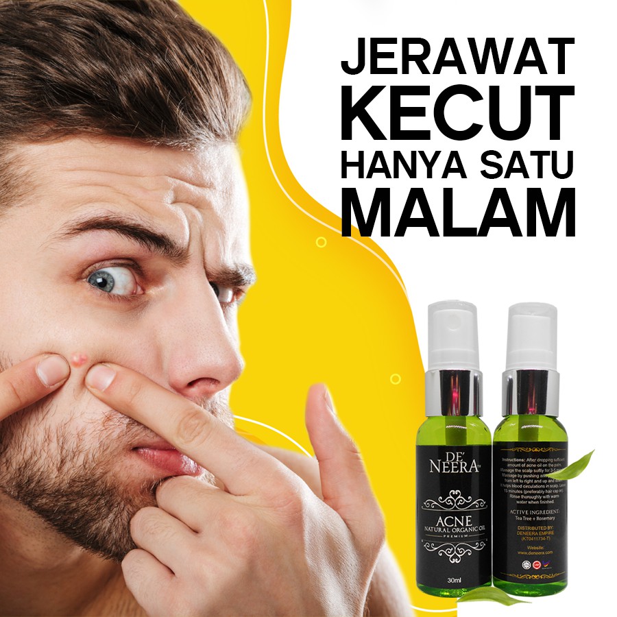 JERAWAT KECUT HANYA SATU MALAM  UBAT JERAWAT BERKESAN 