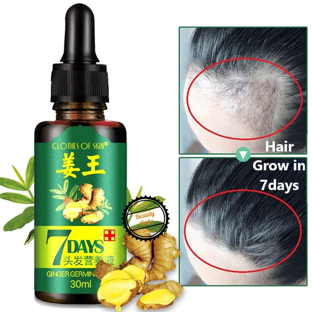 Ginger King Germinal Oil Ginger Hair Growth Essence Hair Growth Serum