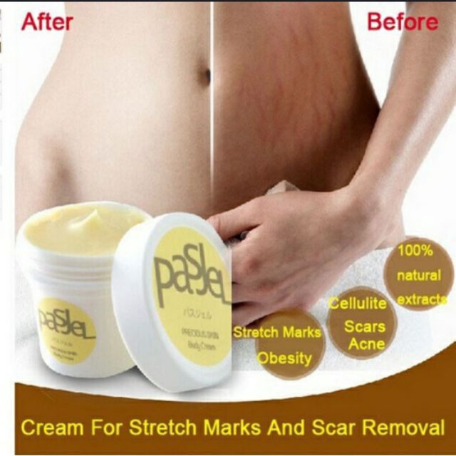 franch stretch marks cream