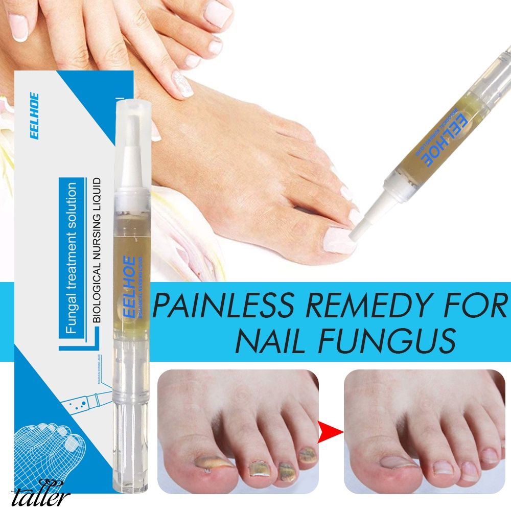 3ml-fungal-nail-treatment-pen-onychomycosis-paronychia-anti-fungal-nail