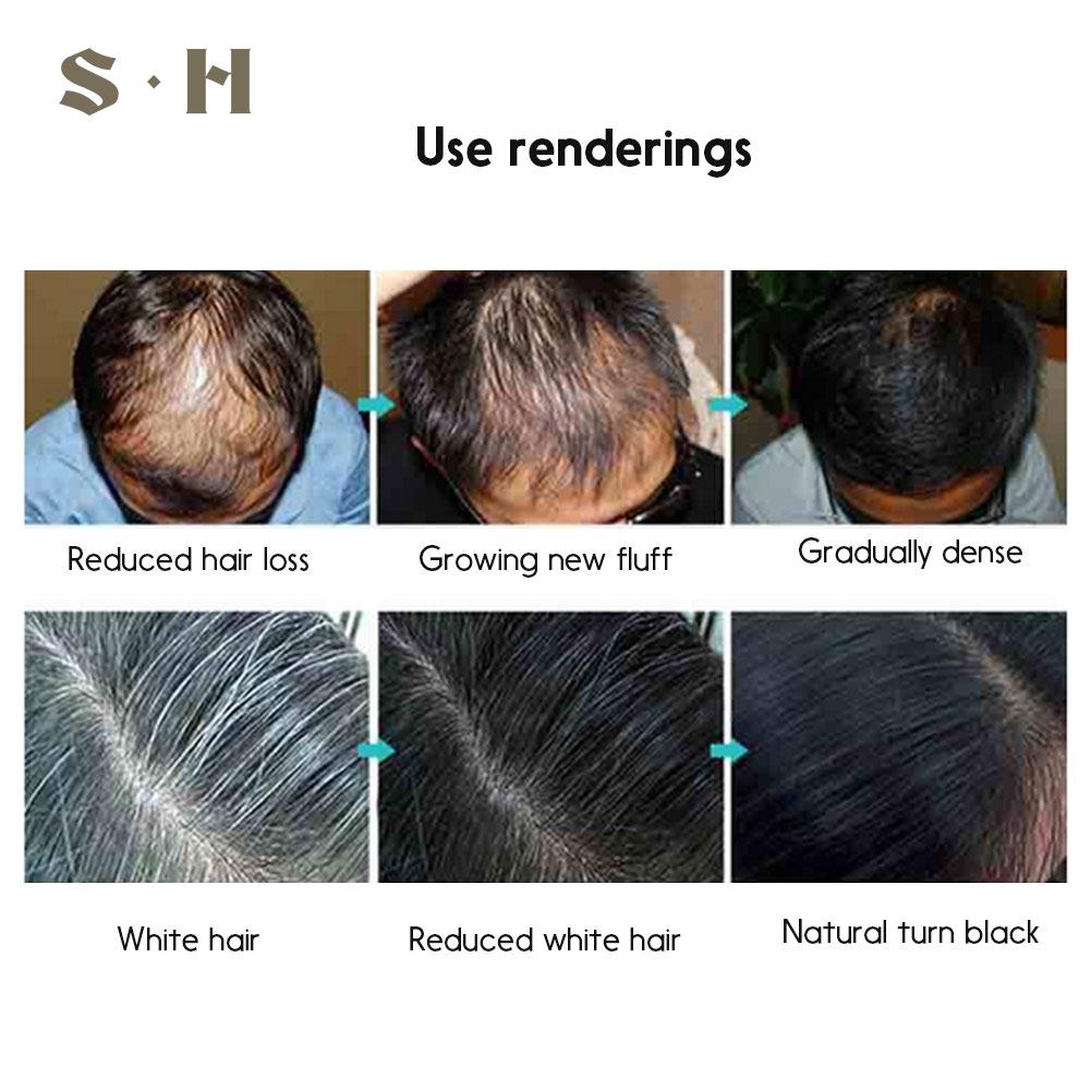Sim Hair Growth Fluid Hair Growth Essence 100ml Healthy Beauty