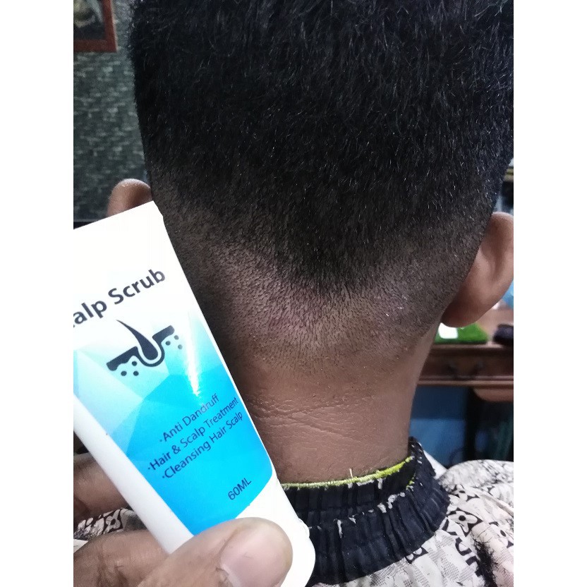 Masalah Kelemumur Kulit Kepala Gatal Kurap Berkuping Scalp Scrub Lazada