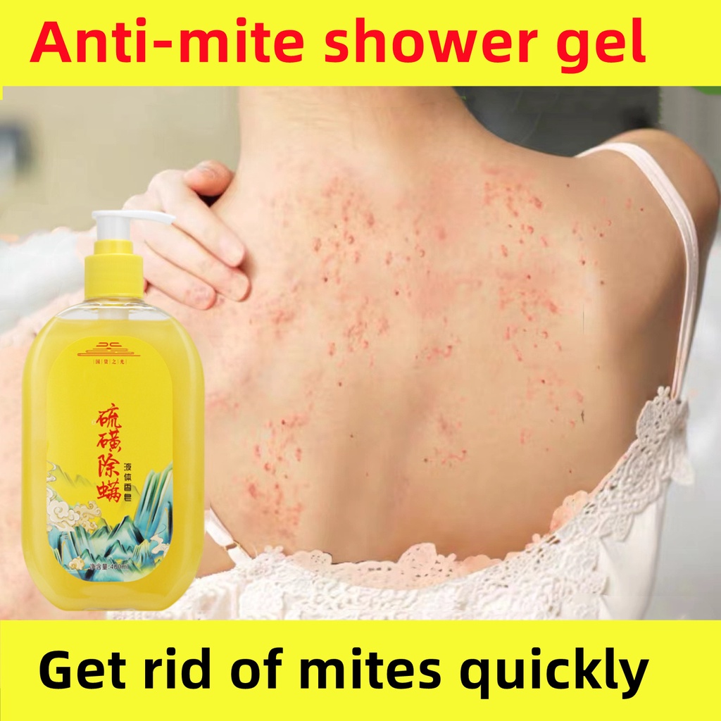 Acne body wash jerawat badan mite removal sulfur soap eczema oil