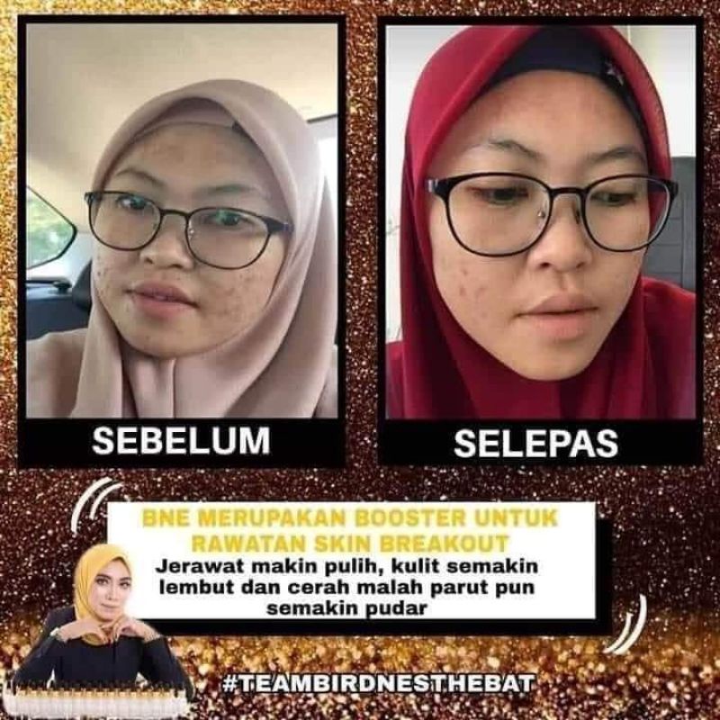 Buy Birdnest Essence By Pna Seetracker Malaysia