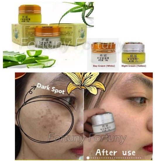 aloe vera for pigmentation