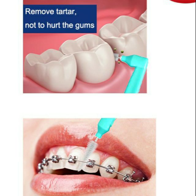 interdental brush for braces