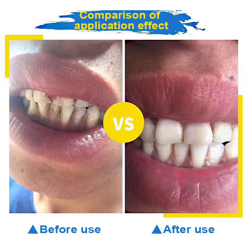 Buy ☀100% Original☀Quick Teeth WhiteningToothbrush Quick Teeth 