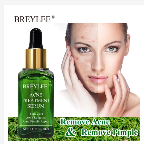 best essence for acne