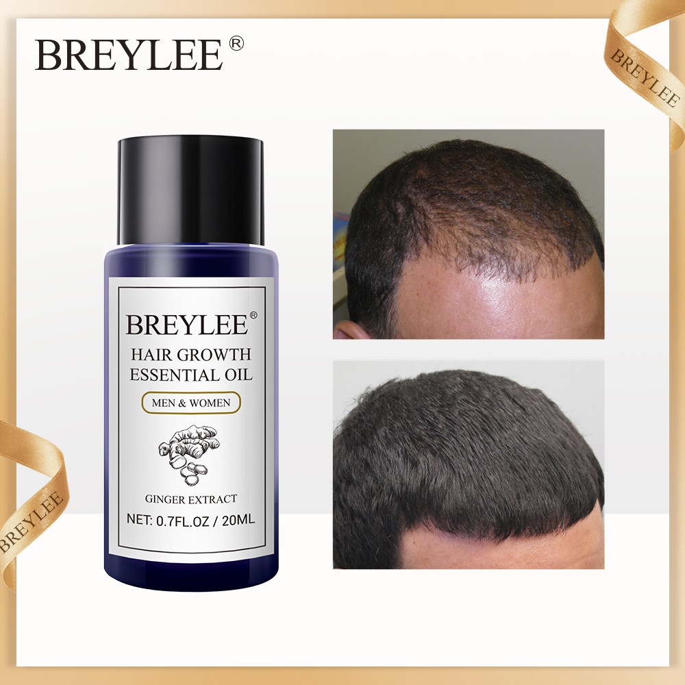 Breylee Hair Growth Essential Oil 20ml Fast Powerful Hair Care