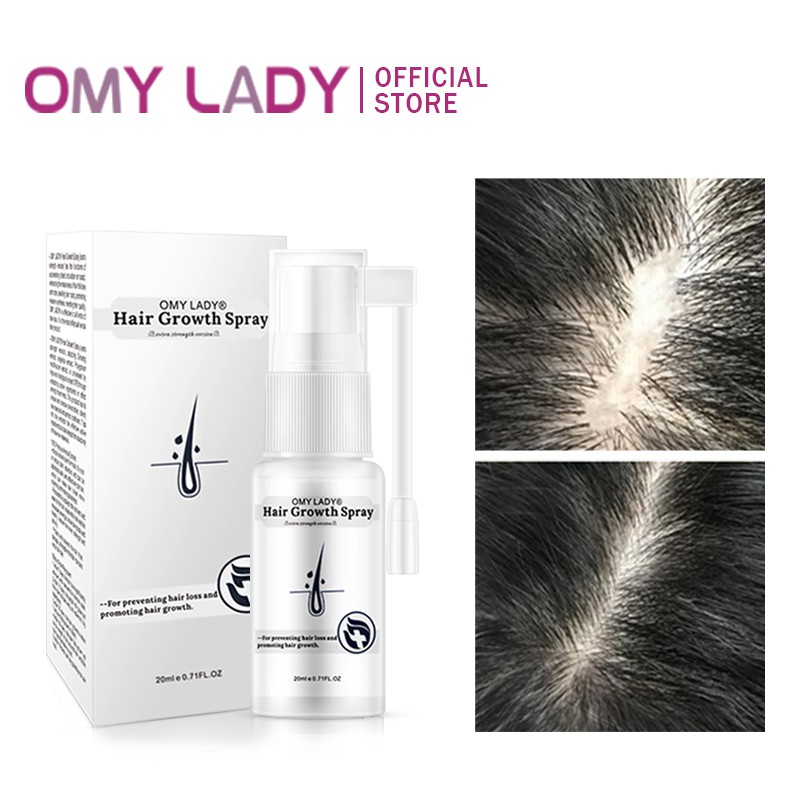 Omy Lady Hair Growth Spray 1pcs Anti Hair Loss Hair Growth Spray