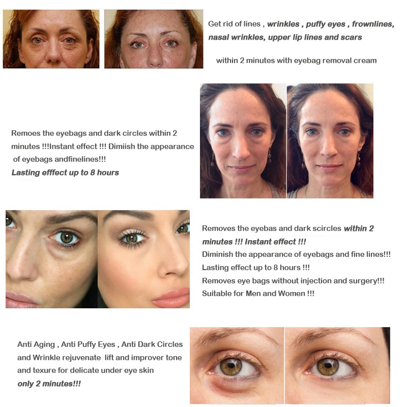 eye bag removal cream