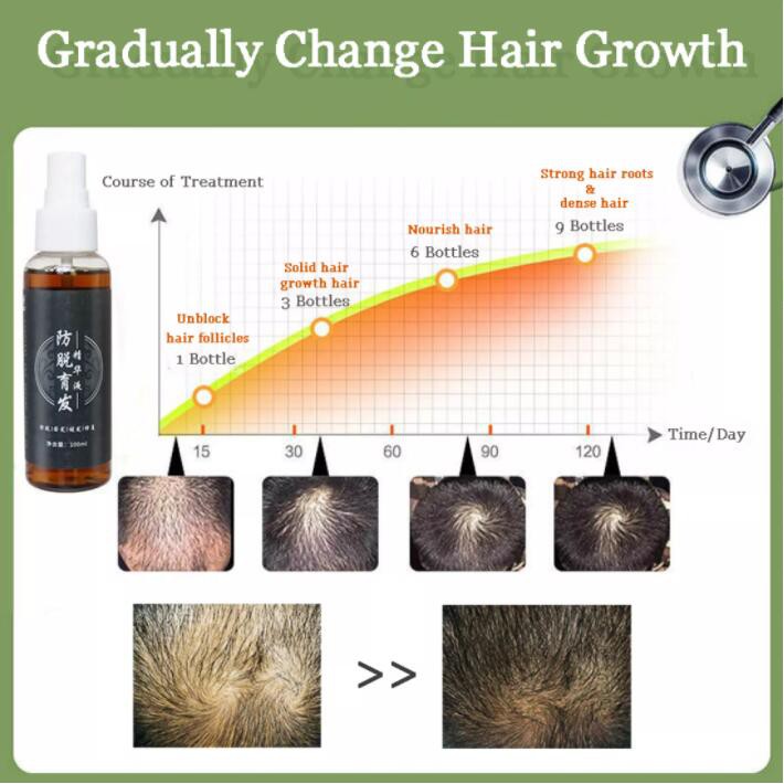 Herbal Essence Fast-promoting Hair Growth Serum Improve Hair Follicle  Nourishing Hair Root Fall Treatment Spray | Shopee Malaysia