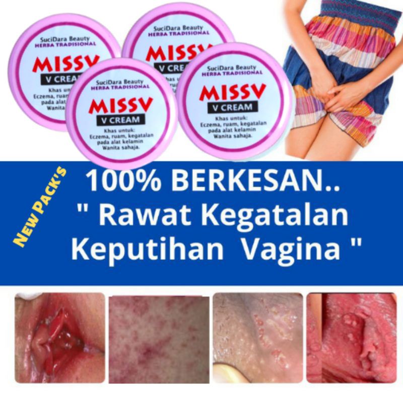 Berkesan Hilang Gatal Celah Peha Rawat Gatal Kemaluan Keputihan Wanita Miss V Miss V Berair Dan Kegatalan Shopee Malaysia