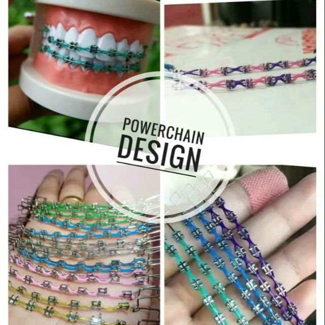 Braces Click Atas Bawah Powerchain Design Shopee Malaysia