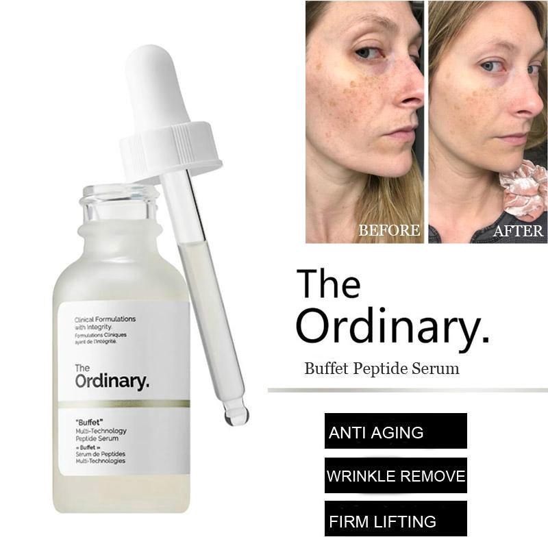the ordinary buffet multi technology
