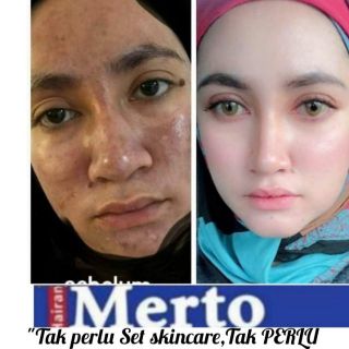 KRIM HILANGKAN JERAGAT/PARUT/JERAWAT  Shopee Malaysia