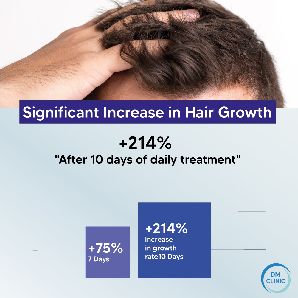 DM Aesthetics ADVANCED HAIR FORMULA(40g) Stimulate Hair Growth + Anti Hair  Loss serum gel: Activates follicle STEM CELLS | Shopee Malaysia