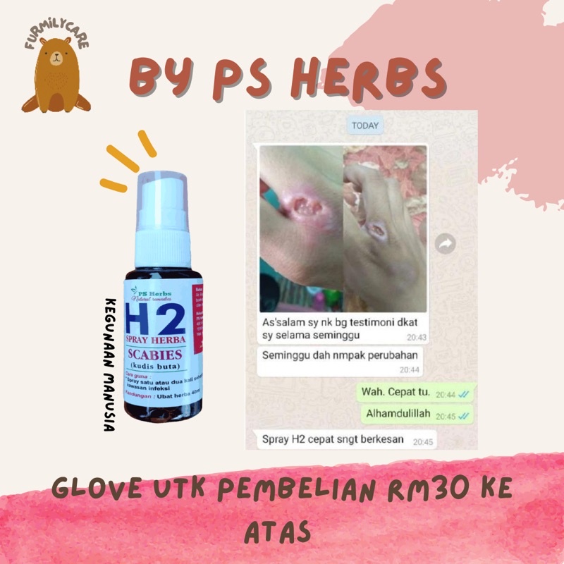 Ubat Scabies Kudis Buta Manusia Kudis Berair Gatal Kulat Air Sporo Manusia Fungus Human Ps Herbs Spray H2 Krim S3 Shopee Malaysia
