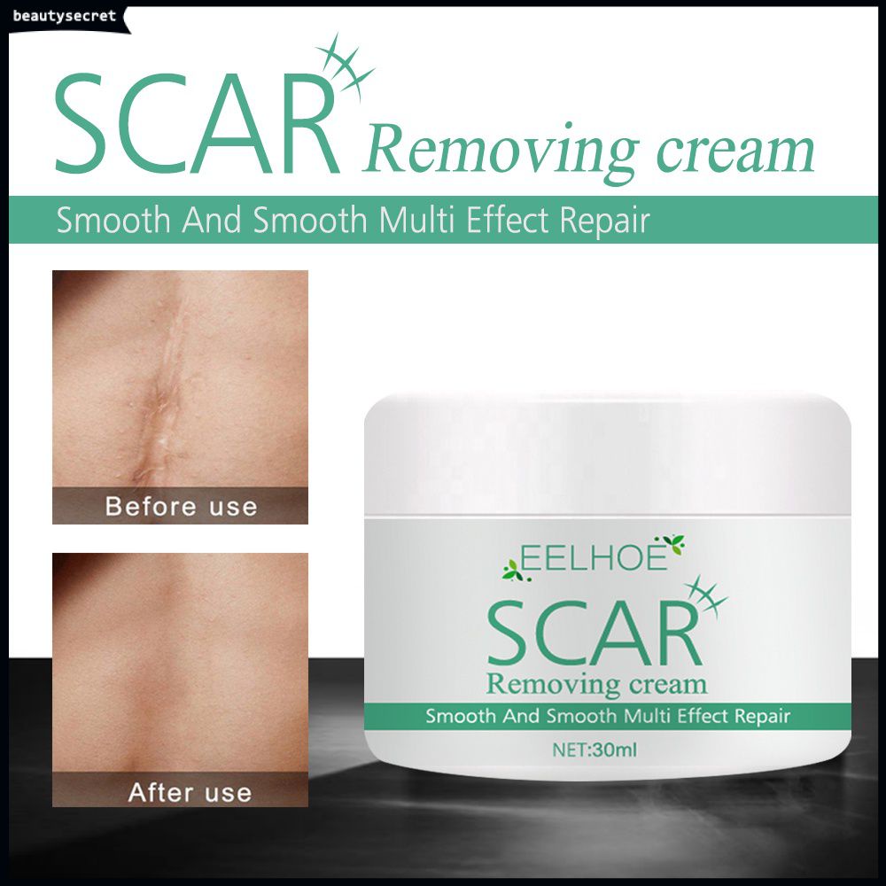 EELHOE scar remover for old scar on leg stretch mark remover acne scar