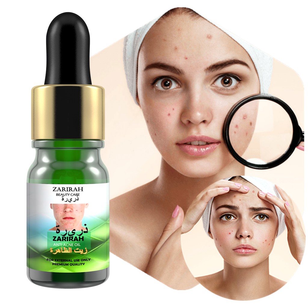 Minyak Kecutkan Jerawat Zarirah Acne Oil 5ml 100 Natural Dzarirah Shopee Malaysia