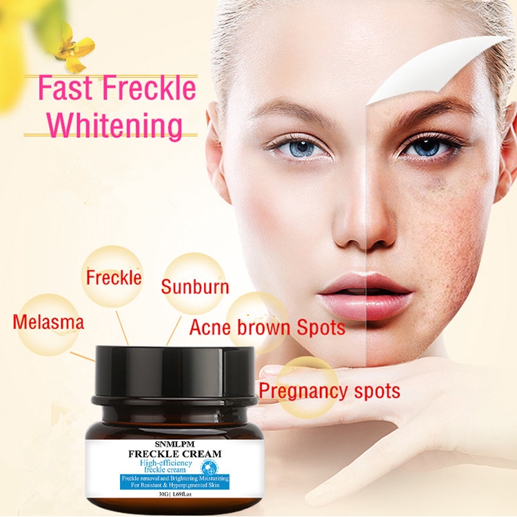 snmlpm freckle cream
