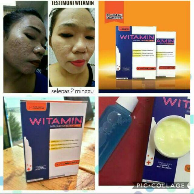 Witamin muka rawat berlubang  Shopee Malaysia