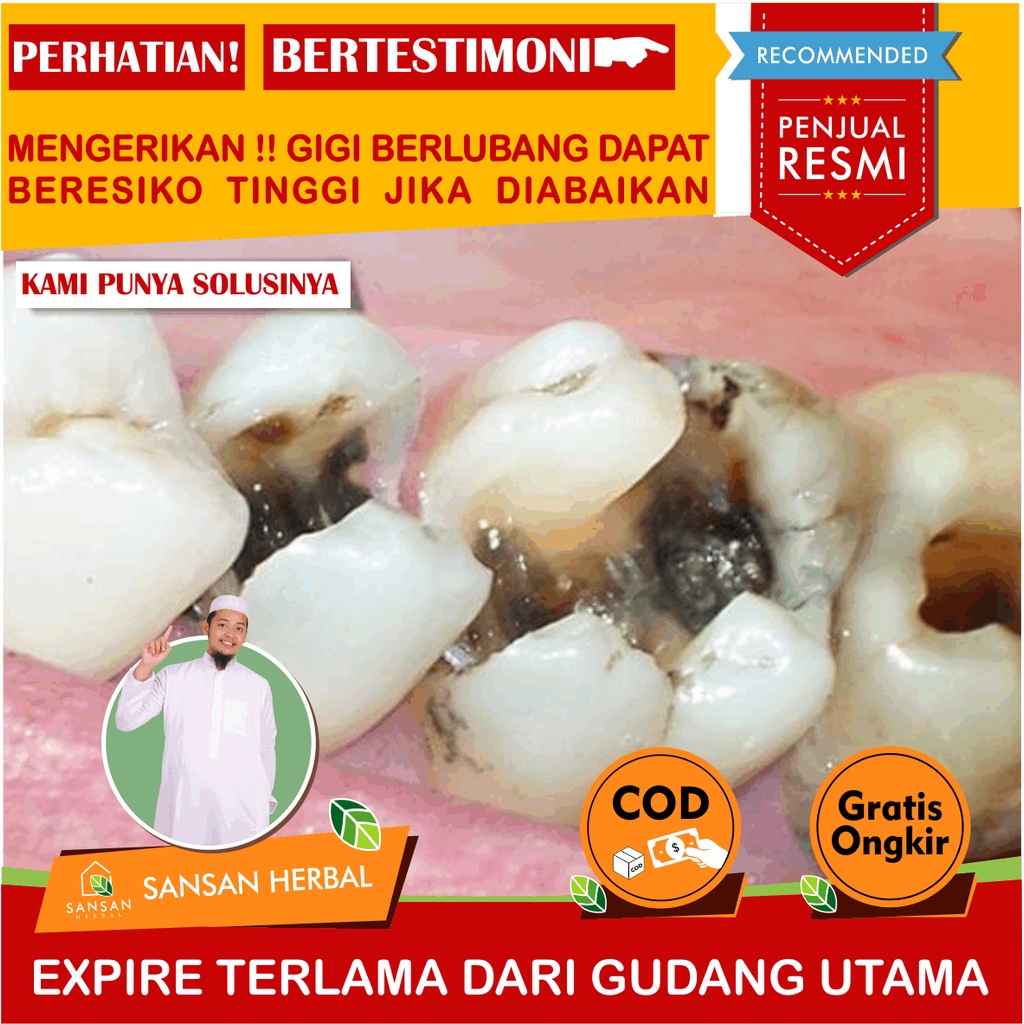 SM Cavities Cavities Tooth Pain Relief Medicine For Cavities, Teeth, Cavities, Teeth, Cavities