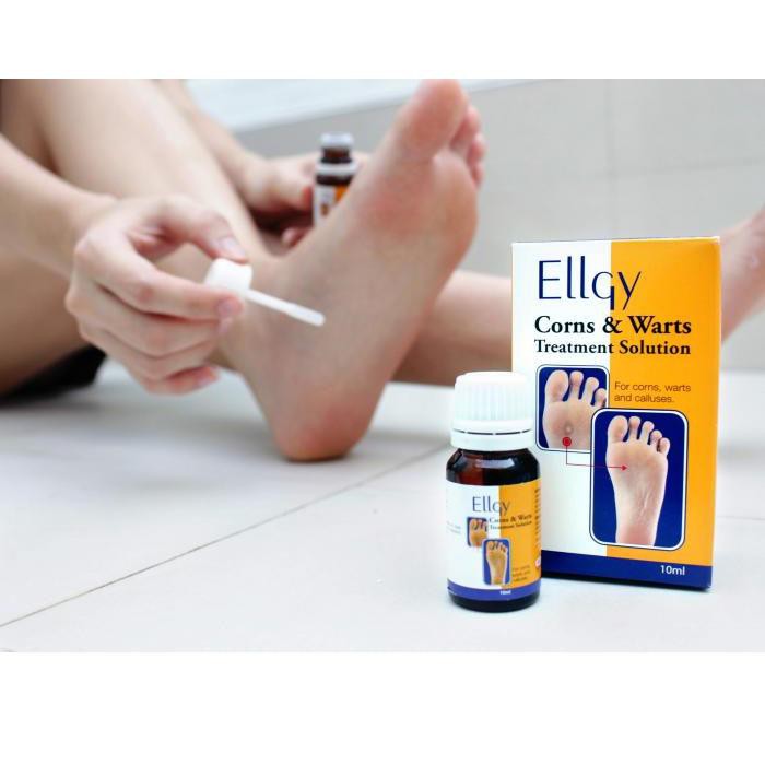 Ellgy Corn Warts Treatment Solution 10ml Shopee Malaysia