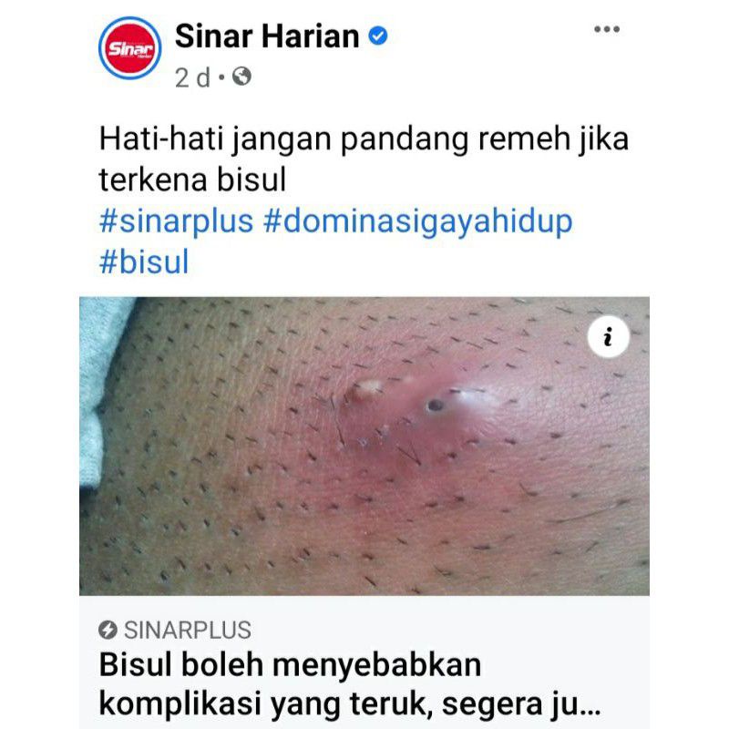 Halal Ubat Bisul Mujarab Warisan 0 02kg Shopee Malaysia