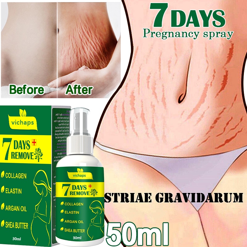 2022 Stretch Mark Spray Repair Removal Acne Scar Stretch Marks Cream