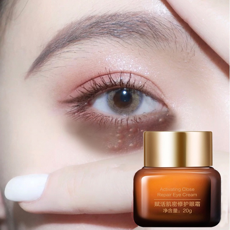 Krim Mata Olay – Bolehkah Ia Mengurangkan Lingkaran Hitam?