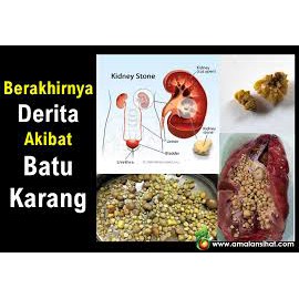 Karang penyebab batu Penyakit Batu