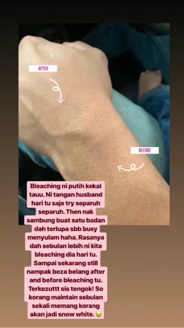 Bleching Body Treatment Shopee Malaysia