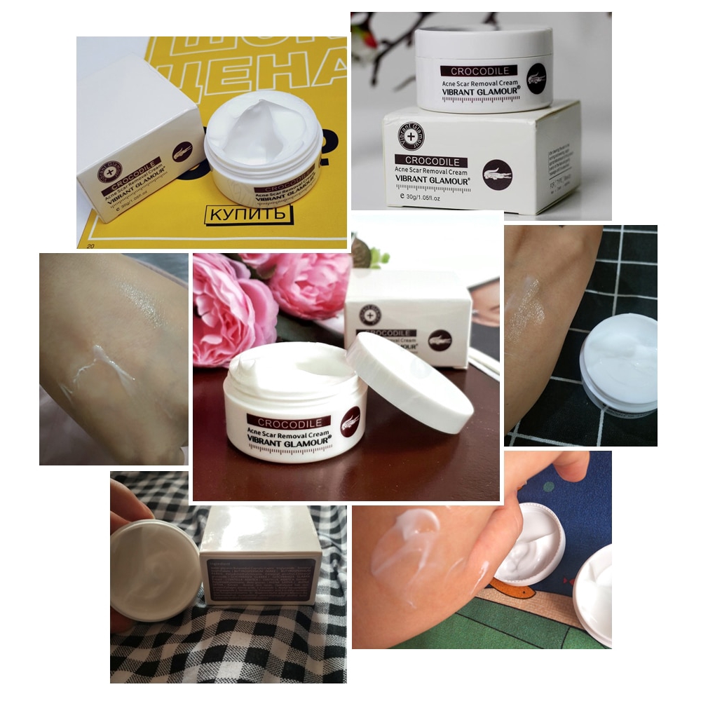 crocodile scar cream