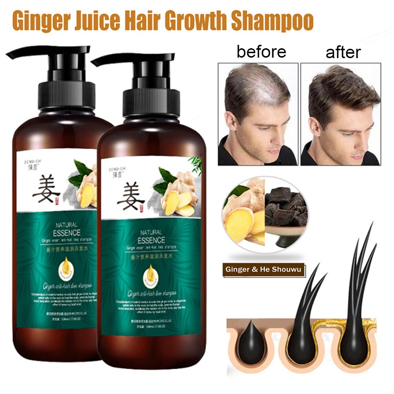(Malaysia Stock) 500ml Ginger Juice Hair Growth Shampoo Anti Hair Loss