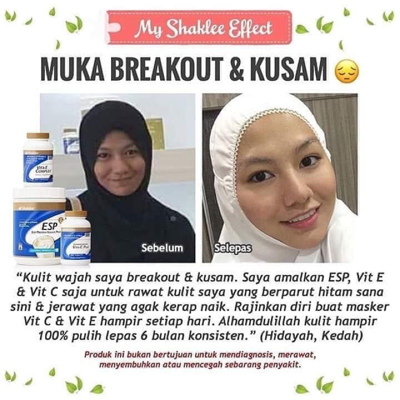 Original Hq Set Cantik Shaklee Hilangkanparut Jerawat Mencantikkan Kulit Esp Vit C Plus Shopee Malaysia