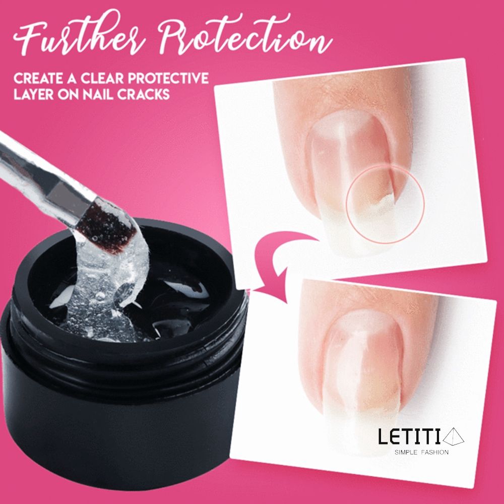 Cracked Nail Repair Gel Nail Damage Repair Phototherapy Glue letitia |  Shopee Malaysia