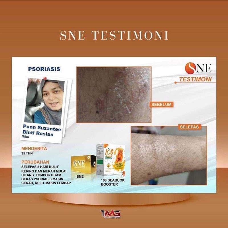 Buy Sne Capsule By Sne Marketing Seetracker Malaysia