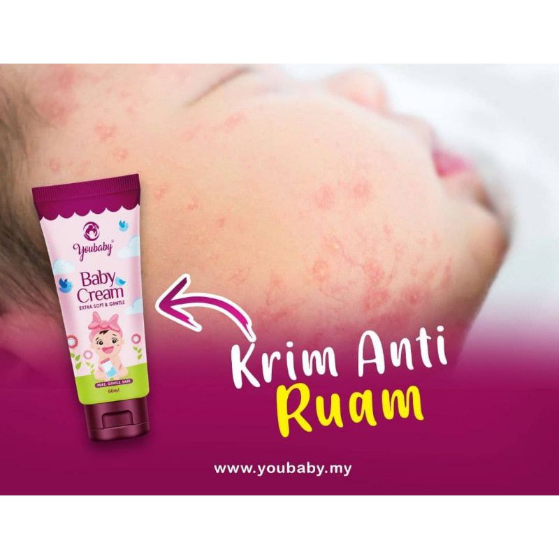 Youbaby Original Hq Krim Dan Mandian Youbaby Anti Ruam Panas Eczema Kurap Panau 3 Free Gift Shopee Malaysia