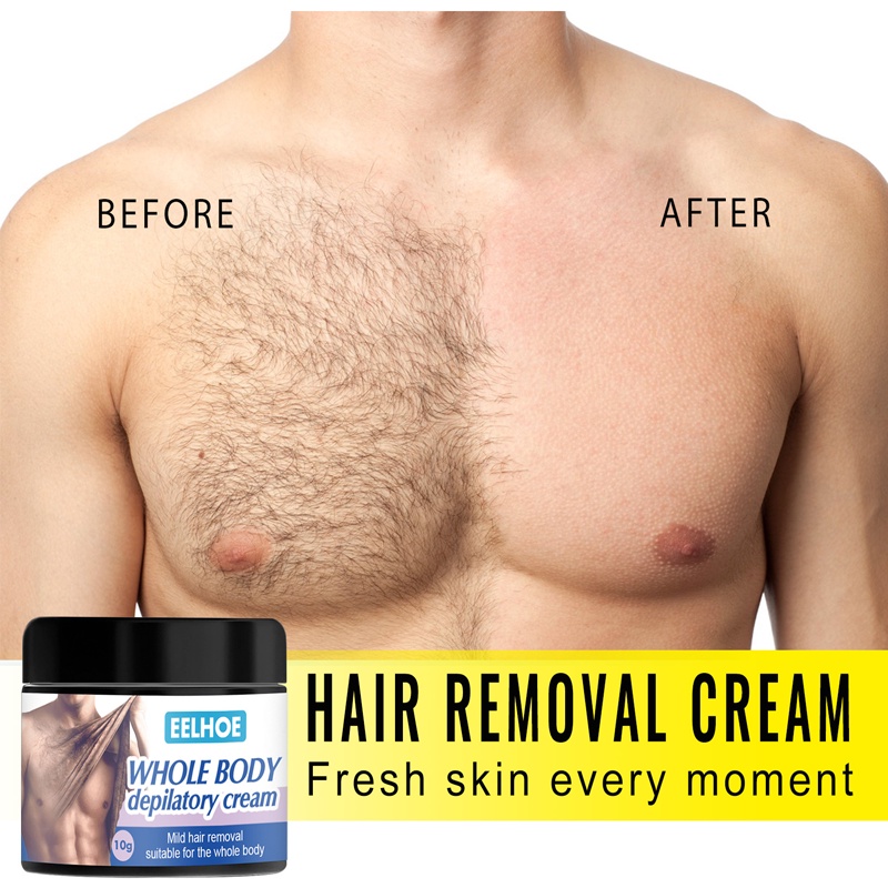 Psoriasis Cream Skin Care Cream Psoriasis Skin Cream Dermatitis Eczematoid  Eczema Ointment Treatment Buy Psoriasis Cream,Psoriasis Skin Cream,Eczema  Ointment Product On | 10pcs Skin Psoriasis Cream Dermatitis Eczematoid  Eczema Ointment Treatment Pso |