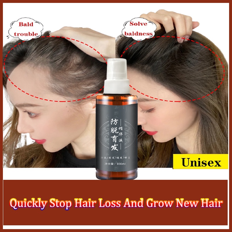 Herbal Essence Fast-promoting Hair Growth Serum Improve Hair Follicle  Nourishing Hair Root Fall Treatment Spray | Shopee Malaysia